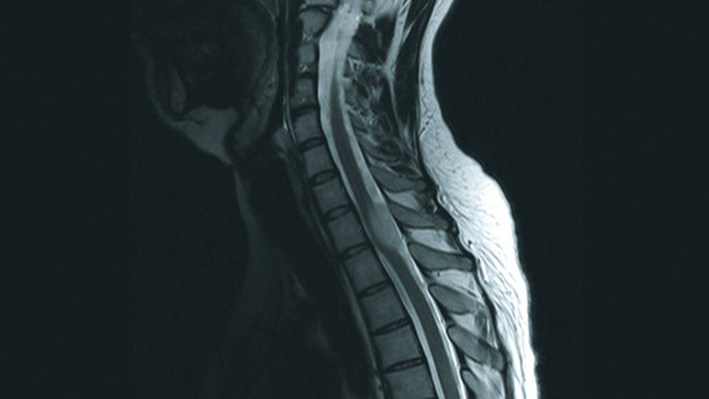 Schnittbilddiagnostik der Wirbelsäule