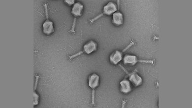 Elektronenmikroskopaufnahme von Phagen.