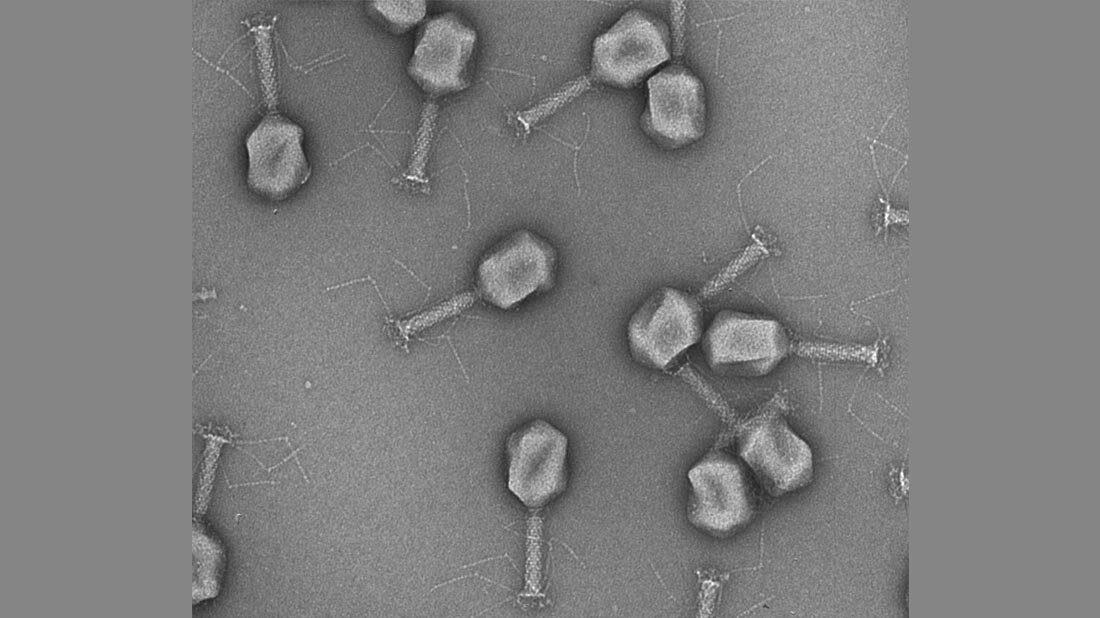 Elektronenmikroskopaufnahme von Phagen.
