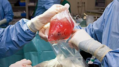 Ein am Uniklinikum Dresden entwickeltes digitales Tool hilft erfolgreich beim Identifizieren potenzieller Organspenden.