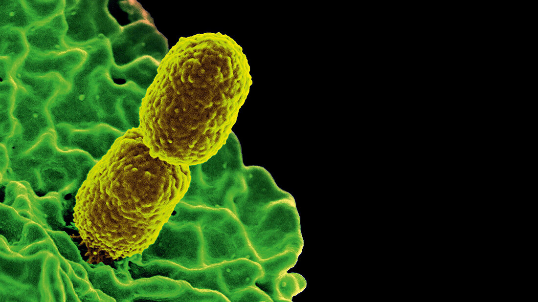 Endoskope als Erregerquelle REM-Aufnahme von Klebsiella pneumoniae
