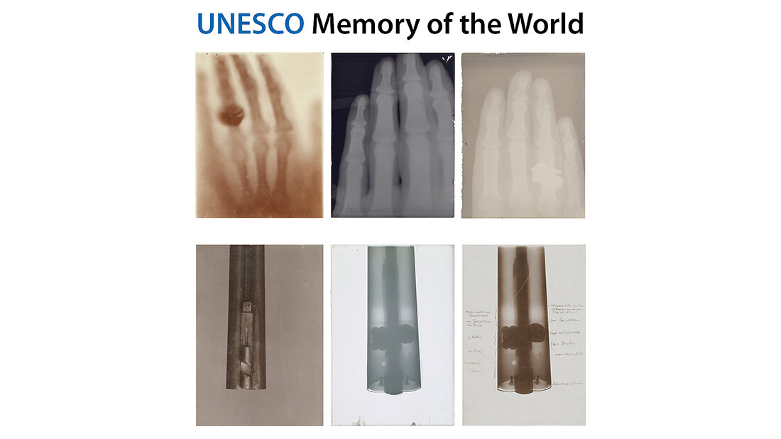Collage der sechs Röntgenbilder, die ins Weltdokumentenerbe der UNESCO aufgenommen worden sind