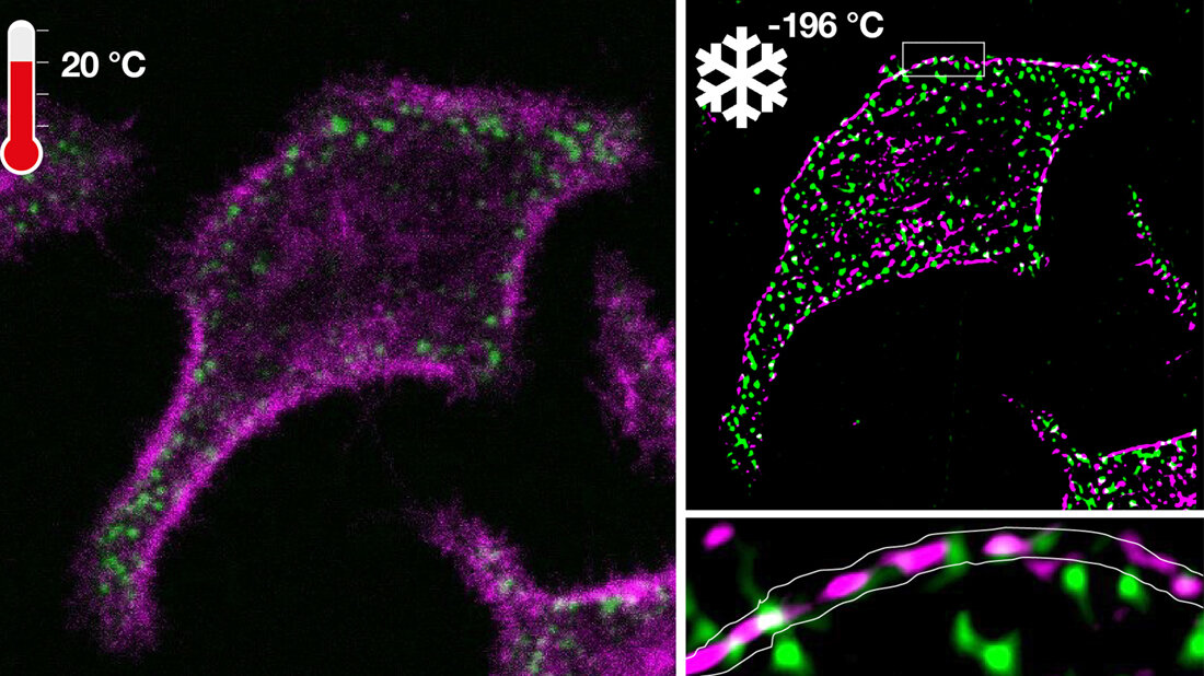 Fluoreszenzmikroskopie 