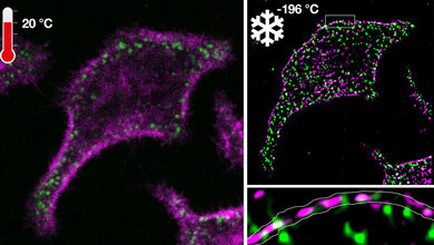 Fluoreszenzmikroskopie 
