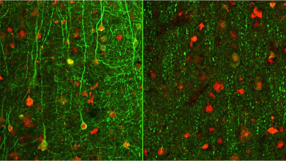 Menschliche Nervenzellen