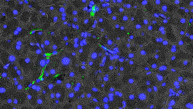 Blaue Punkte auf grauem Hintergrund mit einzelnen grünen Punkten und Linien, Immunfluoreszenzbild des Platelet-derived growth factor α