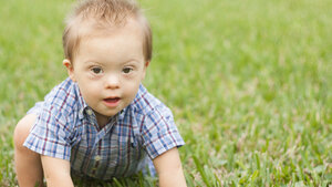 Titelbild zum Fachbeitrag zu genetisch bedingten Hörstörungen bei Trisomie 21