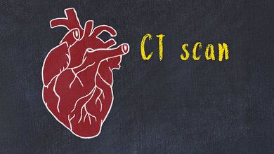 Schematische Darstellung des menschlichen Herzens mti dem Schriftzug „CT scan“
