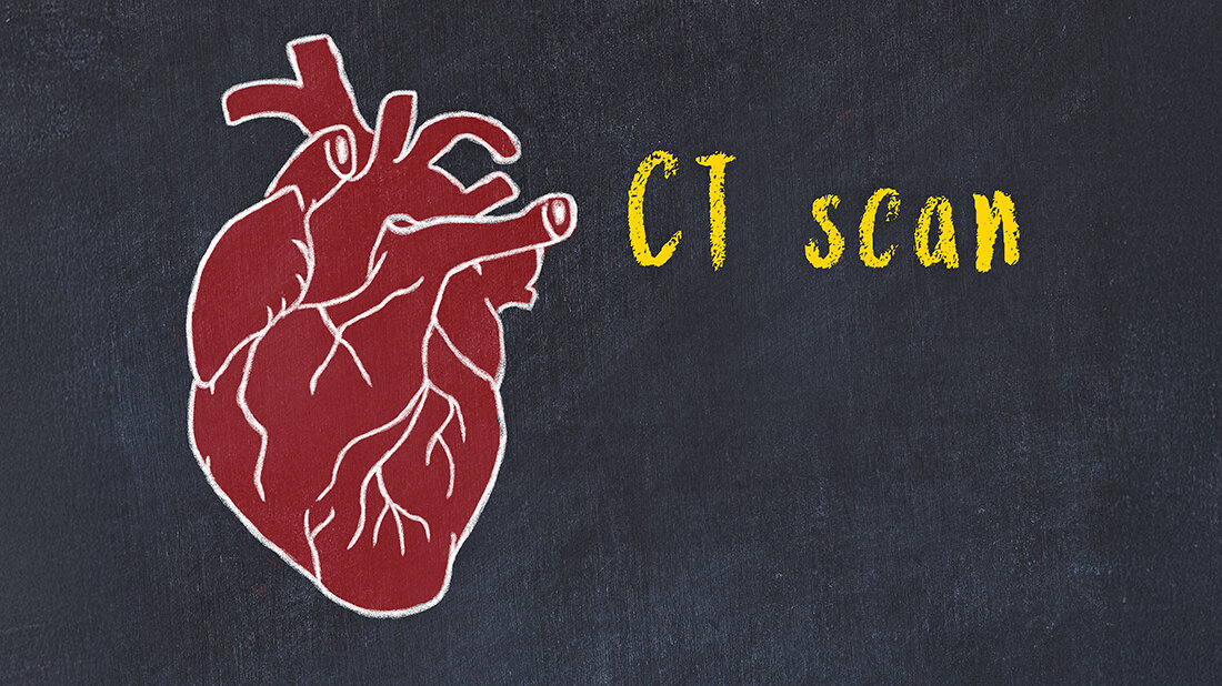 Cardio-CT: die Revolution in der Herzdiagnostik Schematische Darstellung des menschlichen Herzens mti dem Schriftzug „CT scan“