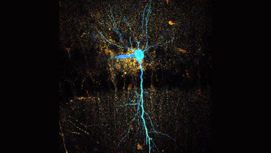 hippocampaler_CA1_Pyramidenneuron.jpg Mikroskopische Fluoreszenz-Lebenszeit-Aufnahme eines hippocampalen CA1-Pyramidenneurons