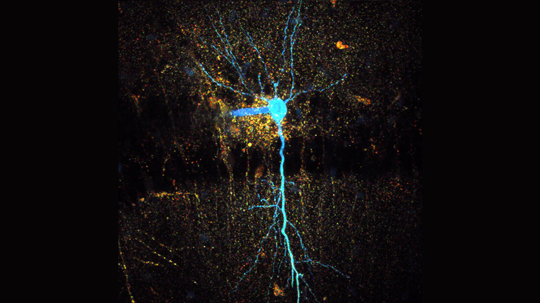 hippocampaler_CA1_Pyramidenneuron.jpg Mikroskopische Fluoreszenz-Lebenszeit-Aufnahme eines hippocampalen CA1-Pyramidenneurons