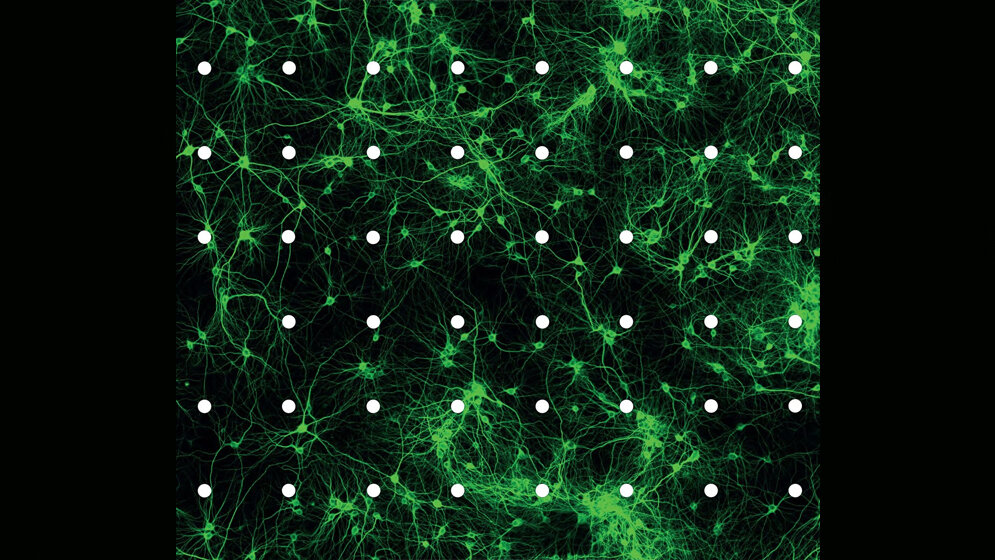 Nach_21_Tagen_in_Zellkultur_bilden_Hippokampus_Neuronen_der_Ratte_vielfaeltige_synaptische_Kontakte_Artur_Bikbaev.jpg Hippokampus-Neuronen der Ratte