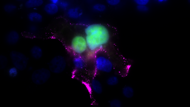 Fluoreszenzmikroskopische Aufnahme von Zellen mit blau gefärbten Zellkernen, grünem Zellinhalt und pinken Strukturen.