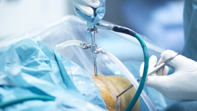 iStock/edwardolive Operationen