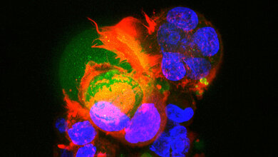 Mikroskopische Aufnahme von Zellen in fluoreszierenden Farben, darunter grün, rot und blau, zur Darstellung biologischer Strukturen.