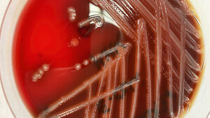 Hämolysierender E. coli auf Blutagar