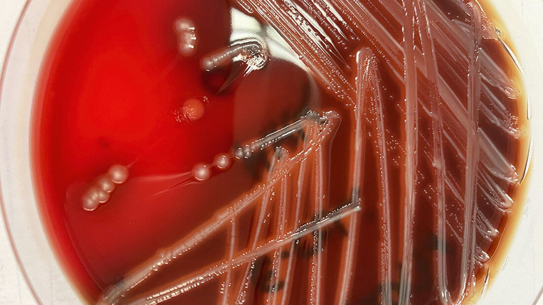 Hämolysierender E. coli auf Blutagar