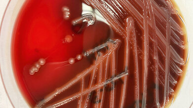 Titelbild_Meissner_VMTA-Schule.jpg Hämolysierender E. coli auf Blutagar