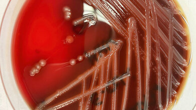 Hämolysierender E. coli auf Blutagar