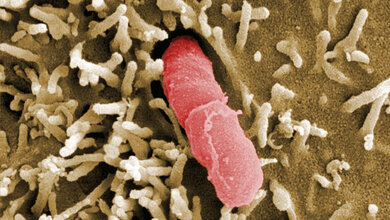 Yersinia pseudotuberculosis
