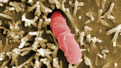 Yersinia pseudotuberculosis