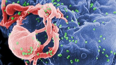 HI-Viren (grün), Lymphozyt