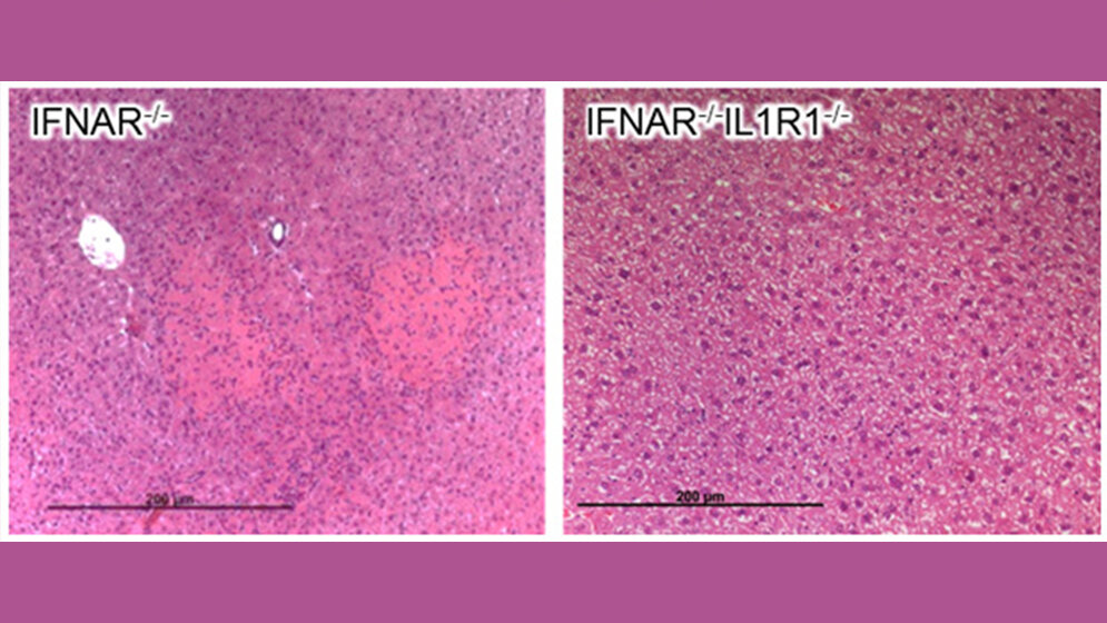 Histologie_von_IFNAR_defizienten_Maeusen_PEI.jpg Histologie von IFNAR-defizienten Mäusen