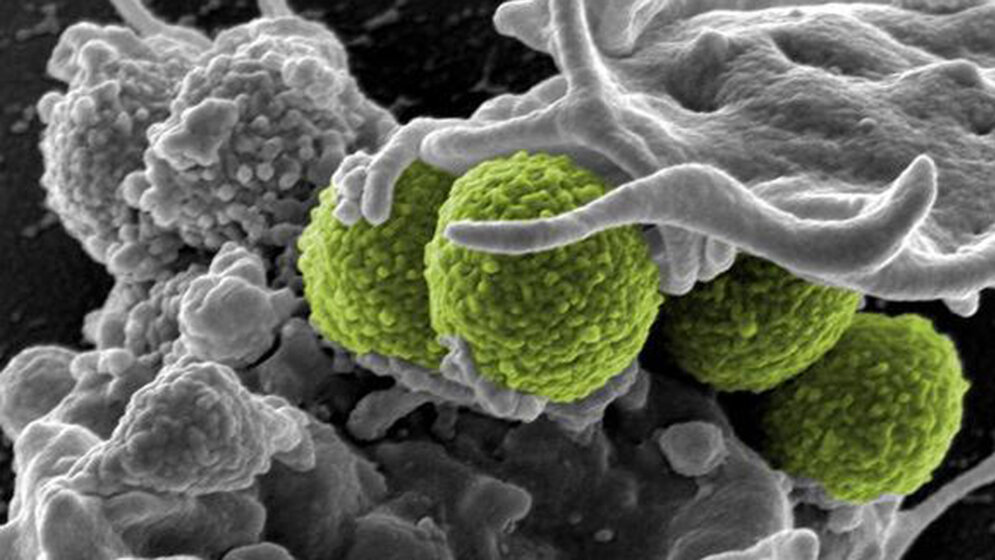 Infektiologie Daten und Fakten über Krankenhausinfektionen