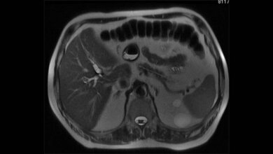 MRT-Sequenzen im Überblick (Teil 1) Radiologie