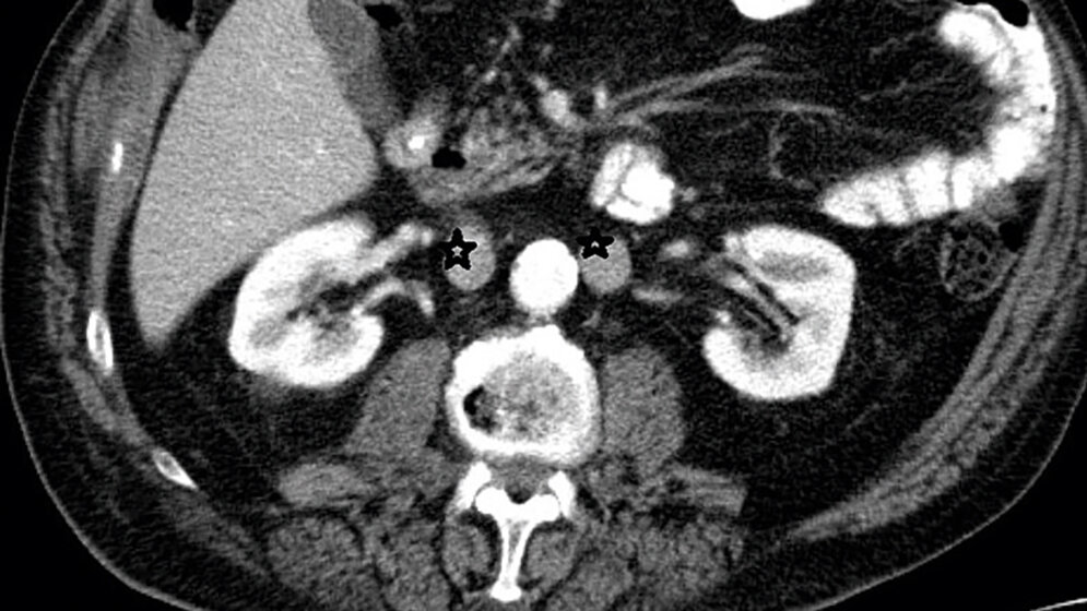 Anomalien und Normvarianten