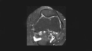 Anomalien und Normvarianten – Skelettale Veränderungen 3.13