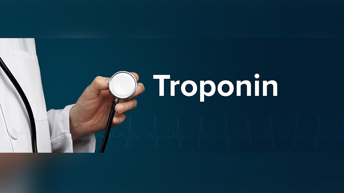 Troponin.jpg Herzmuskeleiweiß Troponin als Indikator für Herzschäden nach Krebsimmuntherapie