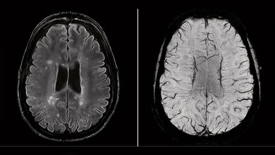 7_Tesla.jpg 7-Tesla-Aufnahmen