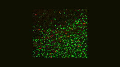 GPD1-positive Zellen