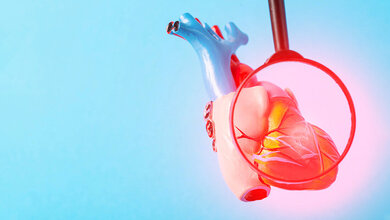 Herzmuskelentzündung