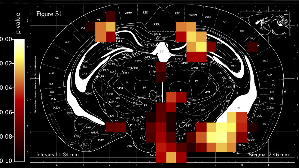 Querschnitt durchs Mausgehirn