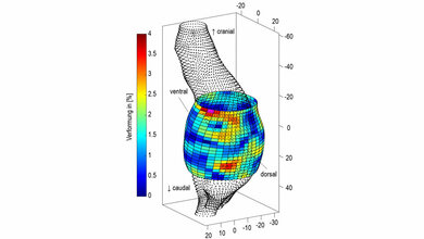 Rekonstruktion_eines_Bauchaortenaneurysmas.jpg Rekonstruktion eines Bauchaortenaneurysmas