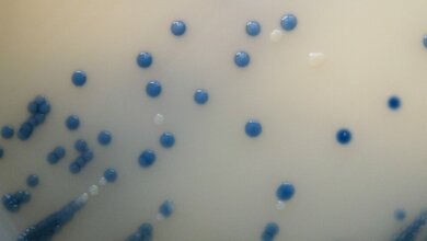 Gibt es Unterschiede zwischen Tag- und Nachtschicht?