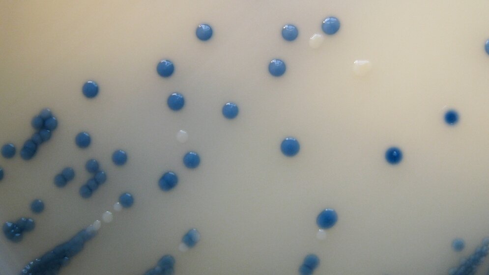 Gibt es Unterschiede zwischen Tag- und Nachtschicht?