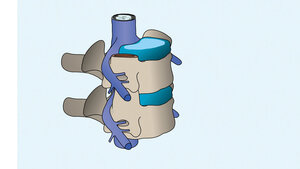 Nucleus pulposus
