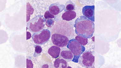 Titelbild zum dritten Teil des Fachbeitrags über Myelodysplastische Syndrome