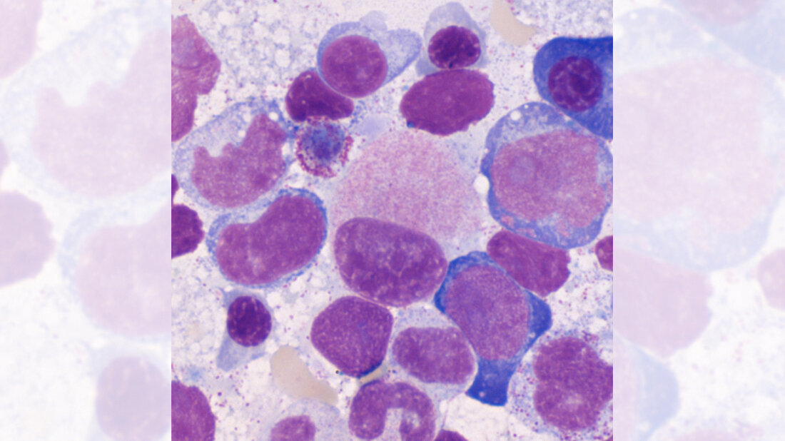 Titelbild zum dritten Teil des Fachbeitrags über Myelodysplastische Syndrome