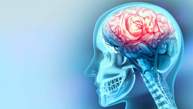 Hirnblutungen besser erkennen