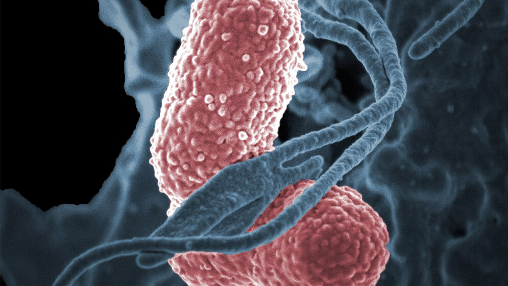 Klebsiella pneumoniae