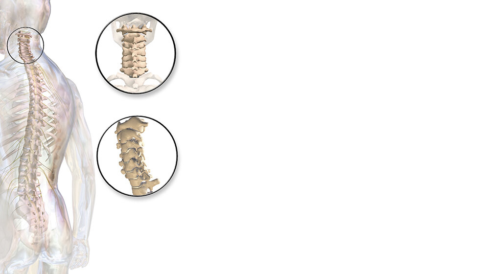 Schnittbilddiagnostik der Wirbelsäule (2.5)