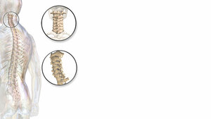 Schnittbilddiagnostik der Wirbelsäule (2.5)