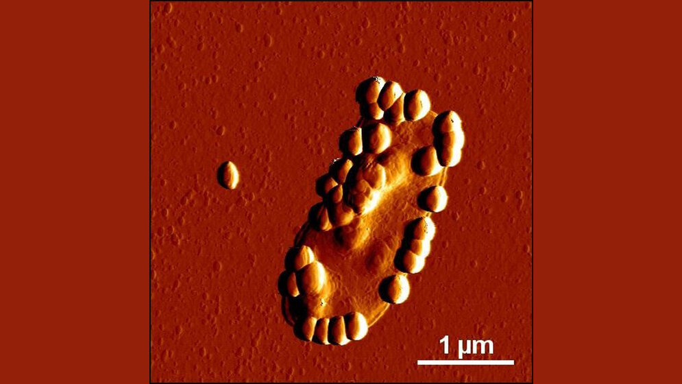 Atomkraftmikroskopische Aufnahme eines Darmbakteriums 