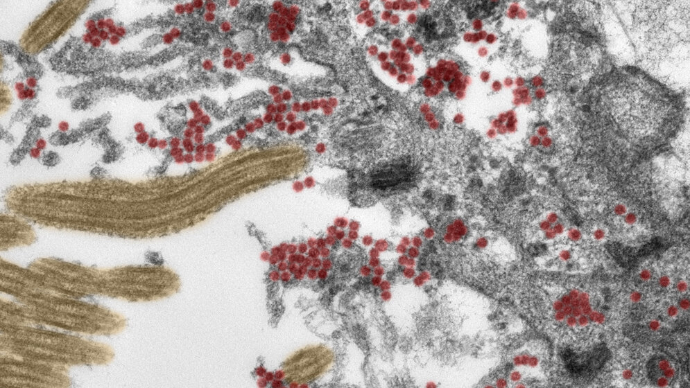 Ausschnitt einer Zelle in der Riechschleimhaut.