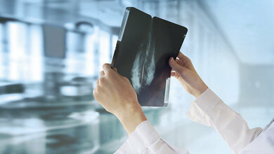 Brustkrebs Röntgenaufnahmen