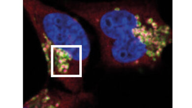 Immunsystem_Krebszellen.jpg Lysosomen IRGQ